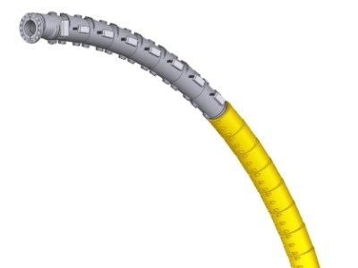 Customizable Hybrid Vertebrae Bend Restrictor